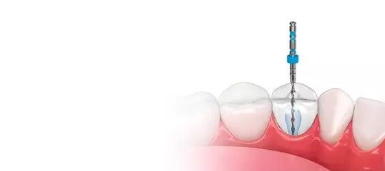 Endodoncia